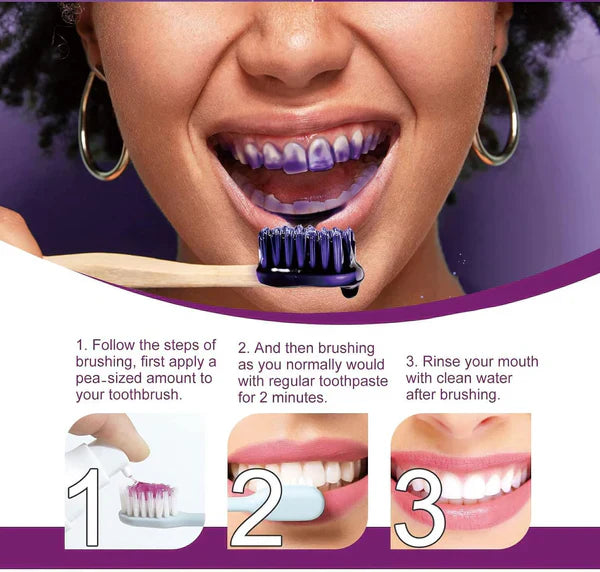 HiSmile V34 Teeth Whitening