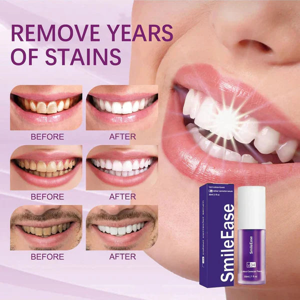 HiSmile V34 Teeth Whitening